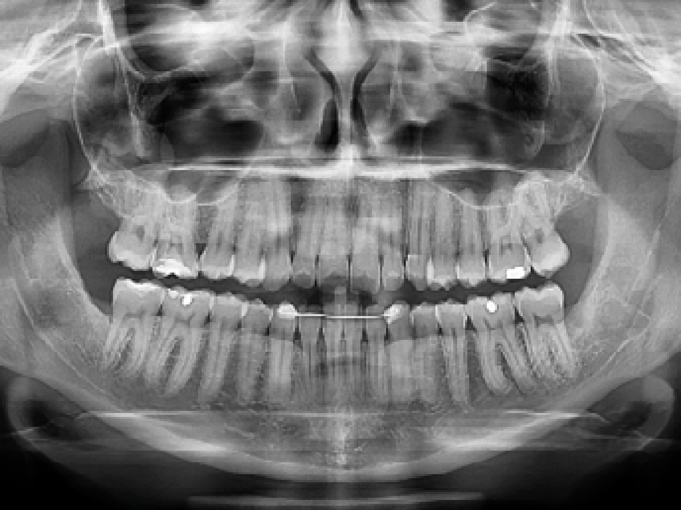 Panorámica Estándar